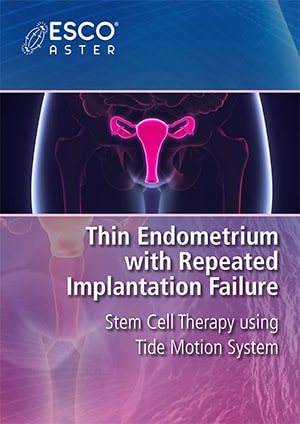 Thin Endometrium with Repeated Implatation Failure: Stem Cell Therapy using Tide Motion System