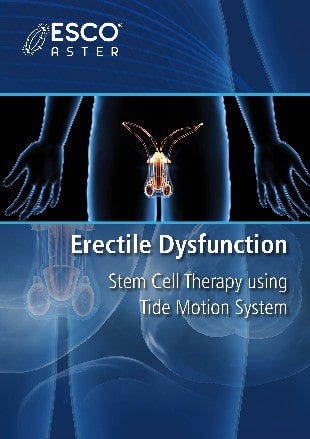 Erectile Dysfunction: Stem Cell Therapy using Tide Motion System